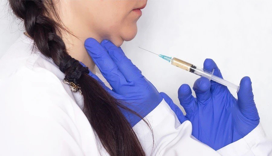 Does Kybella really work